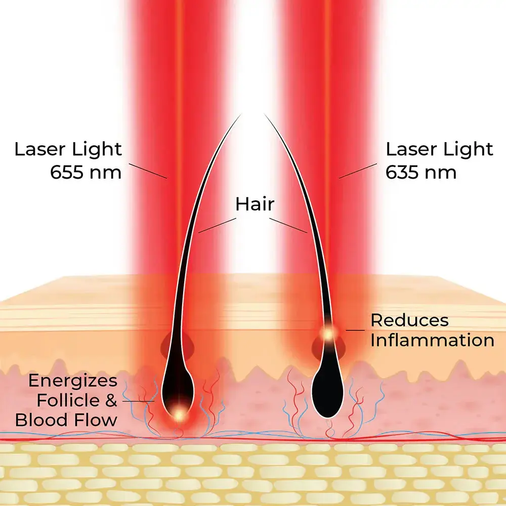 ACTONIS™ 18 DUAL ACTION LASERCOMB - Image 6